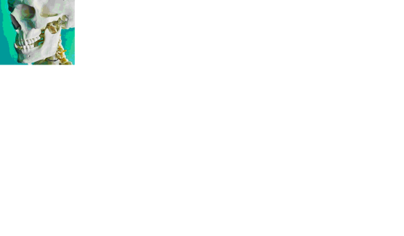 Sch&auml;del - Kiefer -Z&auml;hne